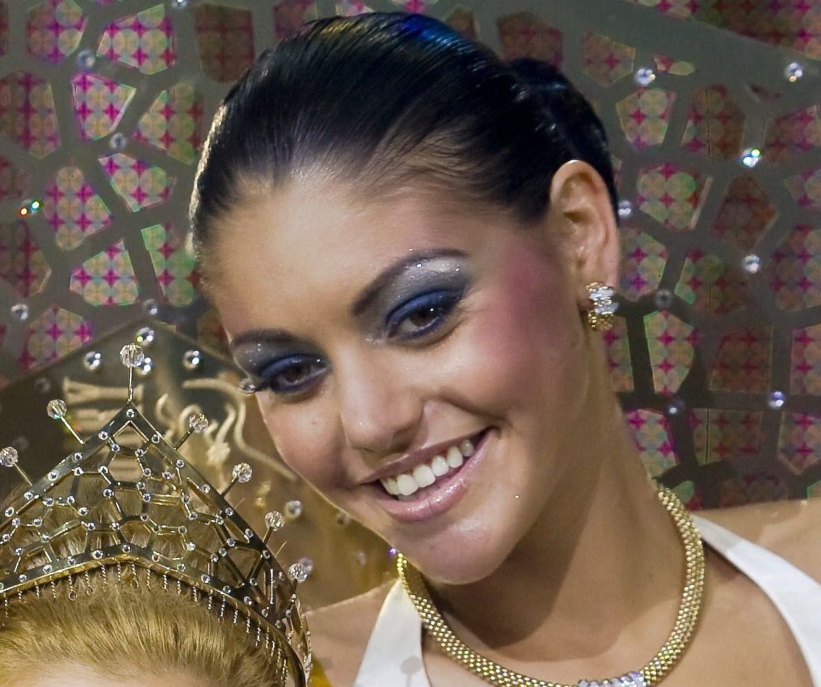 Három plasztikai műtéten esett át a Miss World-második magyar lány