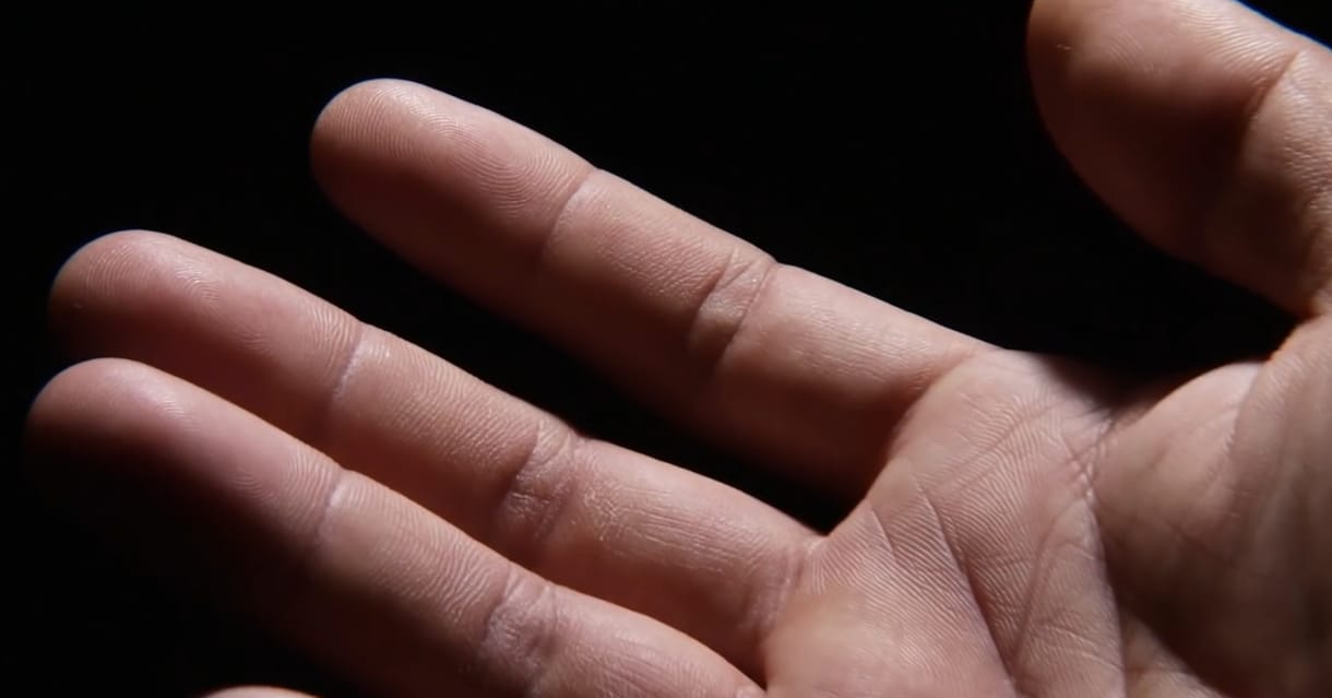 Látott már kézizzadást nagyon közelről? Ha nem, most bepótolhatja