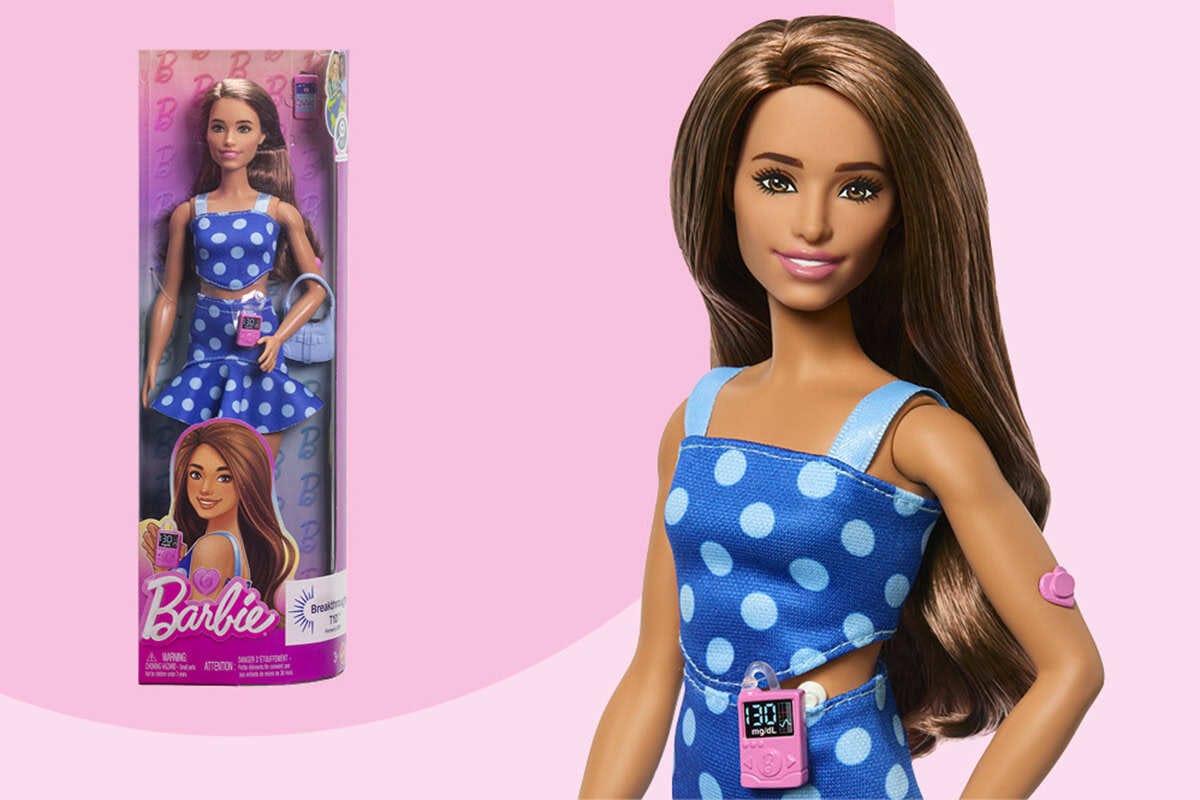 Jön az új Barbie-baba: cukorbeteg és inzulinpumpája is van