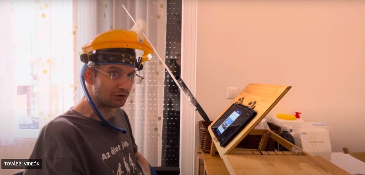 Karsai Dániel újabb videóban mutatta meg, hogyan romlott az állapota: „Önök szerint ez méltóságteljes élet?”