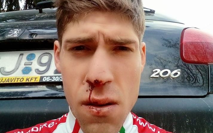 Kerékpáros előzte meg a lassú autóst, összeverték