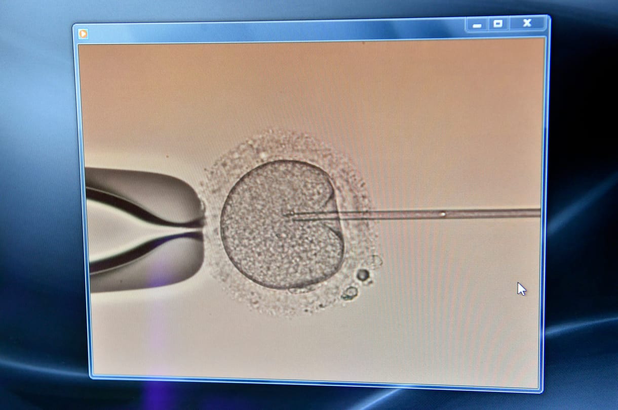 Először sikerült laborban emberi petesejtet növeszteni