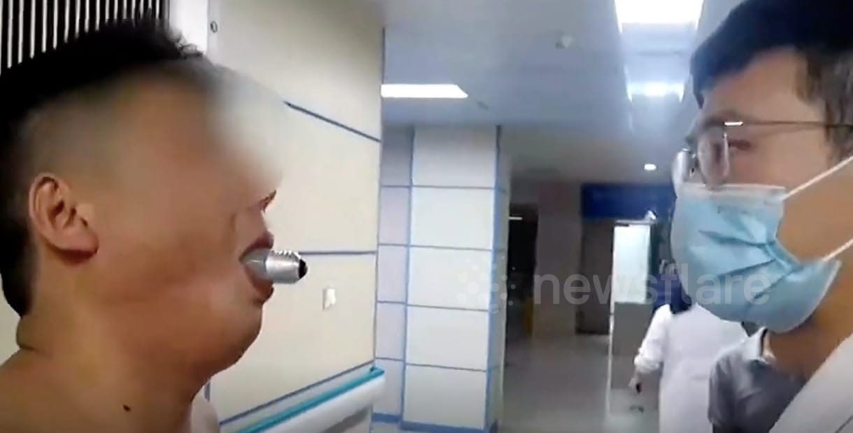 Látott egy videót arról, ahogy valakinek beleragad a szájába egy villanykörte, kipróbálta