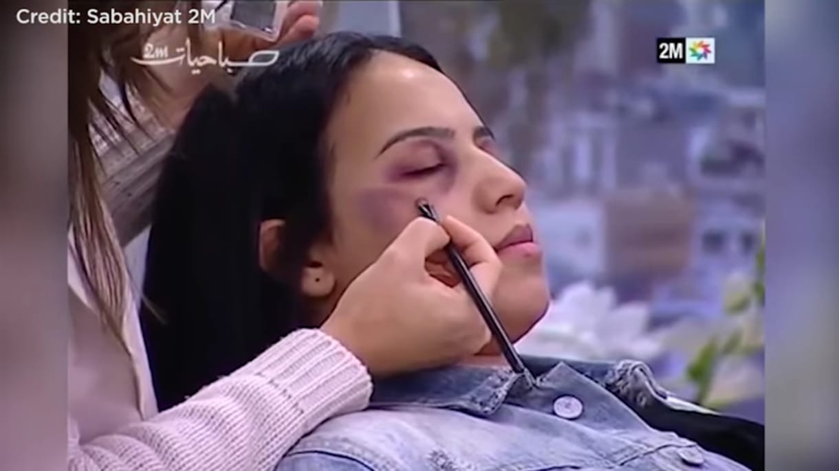 Megmutatta egy marokkói tévé, hogyan sminkeljenek a bántalmazott nők