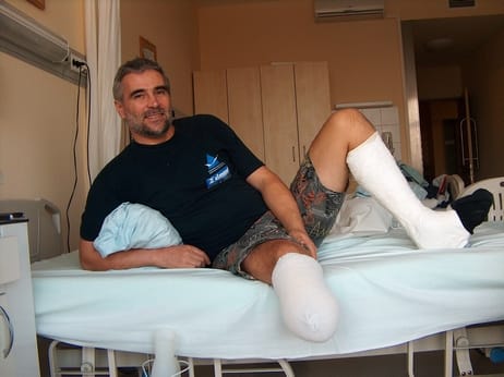 Erőss Zsolt: „Nekem nem akármilyen műláb kell”