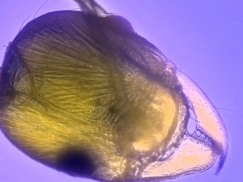 10 lenyűgöző kép, amit csak mikroszkóppal láthatna