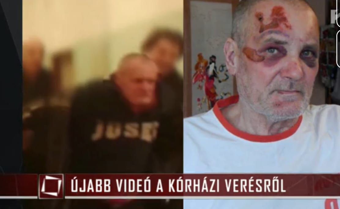 Újabb videó került elő a kórházi betegverésről