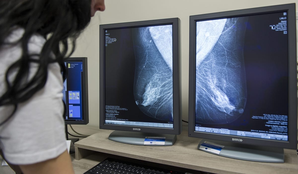 Túl nagy volt a melle a vizsgálathoz: hazaküldték a mammográfiáról