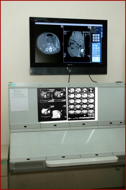 Informatikai fejlesztések vihetik előre az egészségügyet