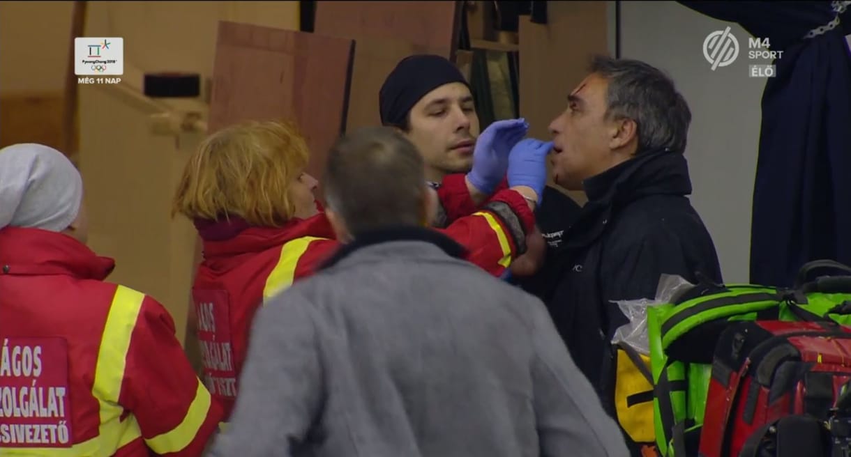 Brutális hoki: szilánkok vágták meg az operatőr arcát – videó