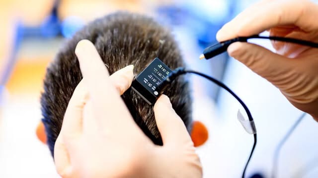 Áttörést hozhat egy új agyi implantátum, ami valós időben alakítja beszéddé a gondolatokat