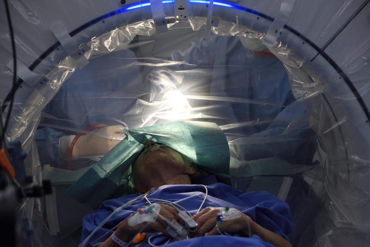 Bravúros műtét Szegeden: agyi pacemakert ültettek be egy Parkinson-kórban szenvedő betegnek