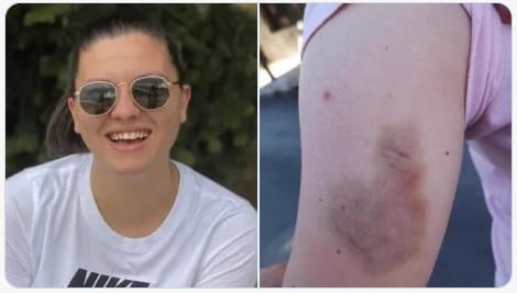 Azért bírságoltak meg egy nőt Montenegróban, mert bemosott a férfinak, aki szexuálisan zaklatta