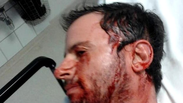 Véresre vertek a migránsok egy bevándorláspárti politikust – Tudja, mivel verték át szeptemberben?