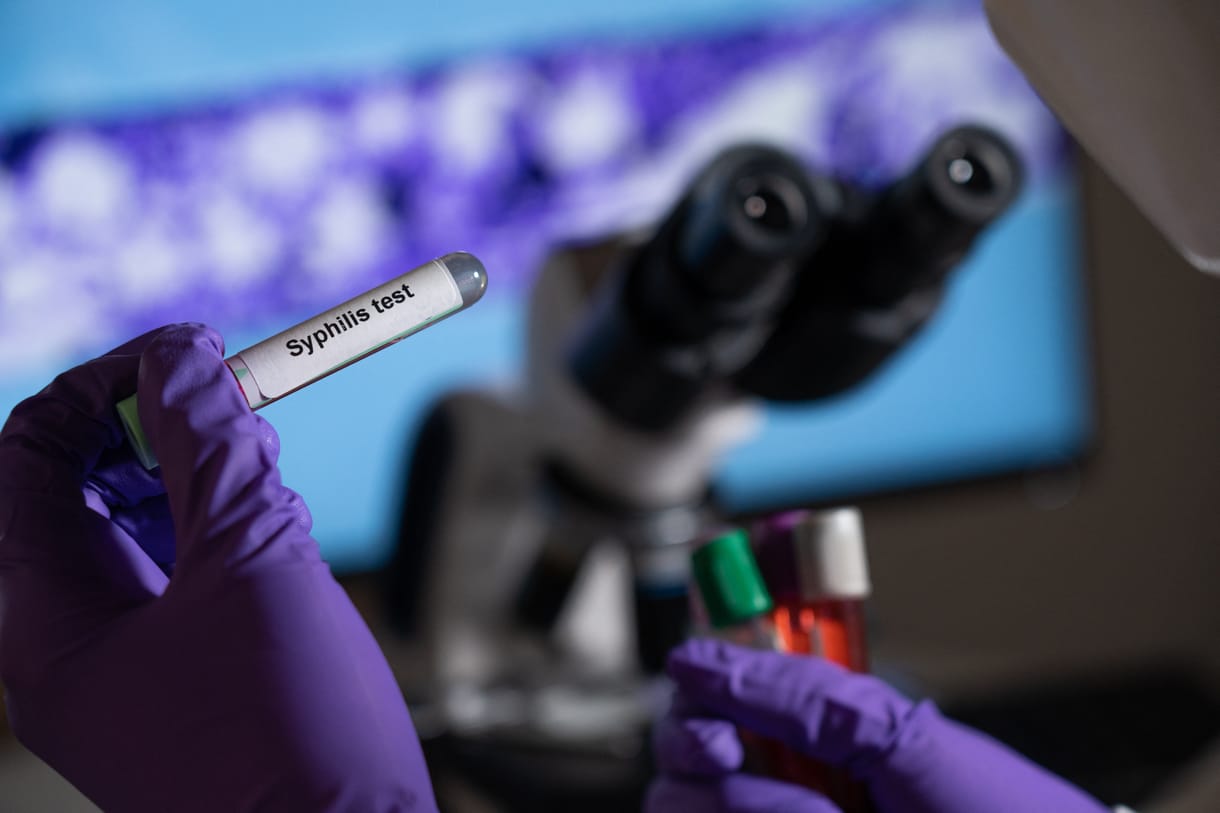 Az elmúlt tíz évben megduplázódott a szifilisszel diagnosztizáltak száma