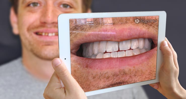Egy programmal előre látható a fogorvosnál, milyen lesz a végeredmény – videó