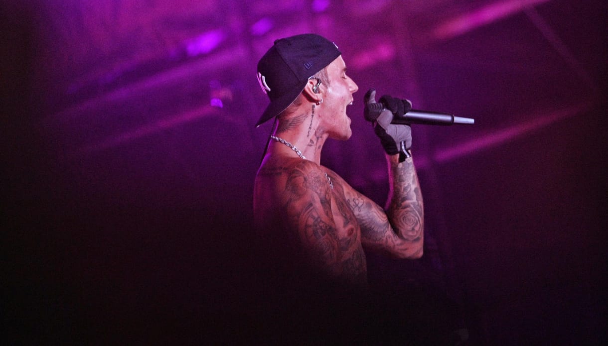 Justin Bieber arcbénulása egész jól gyógyul