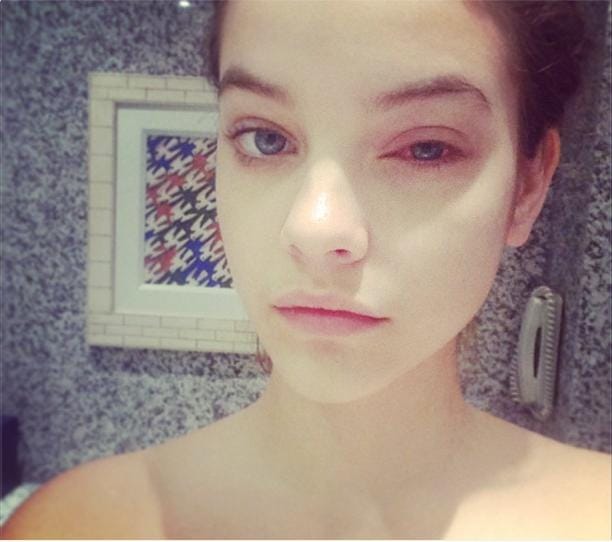 Fotó: rettenetesen néz ki Palvin Barbara szeme