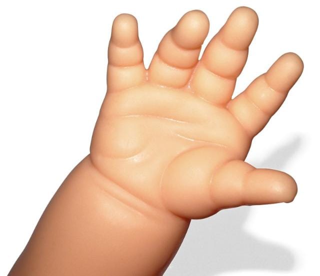 A kövér gyerekekről beszélnek három napig Pécsen