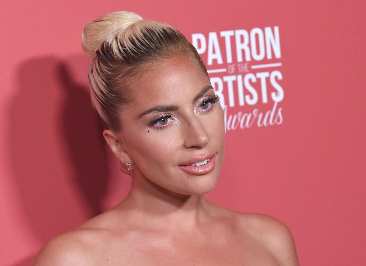 Meglettek Lady Gaga elrabolt kutyái