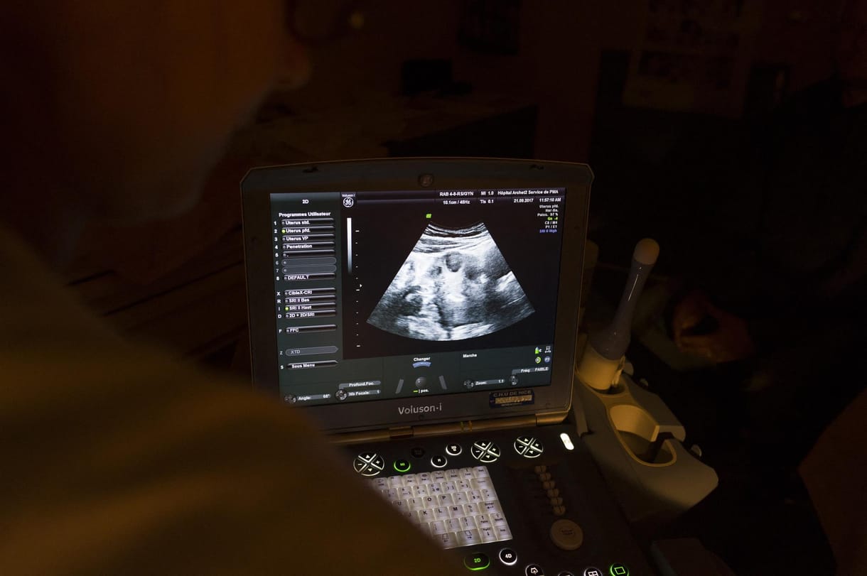 Az Európa Tanács elítélte az új magyar abortuszrendeletet