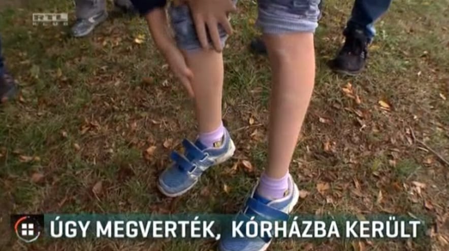 Autista unokatestvérét próbálta védeni a Berkeszen megvert 11 éves fiú