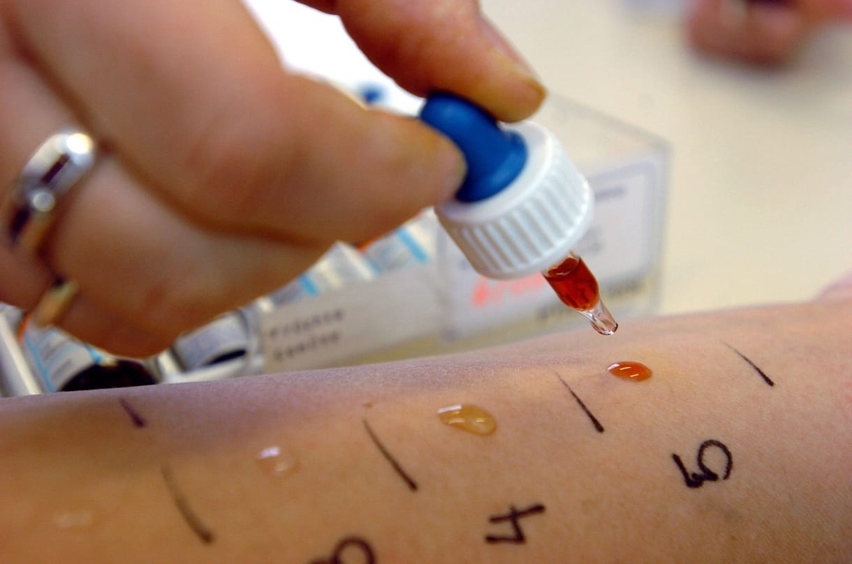 Asztmásoknak és az allergiásoknak is javasolják az oltást