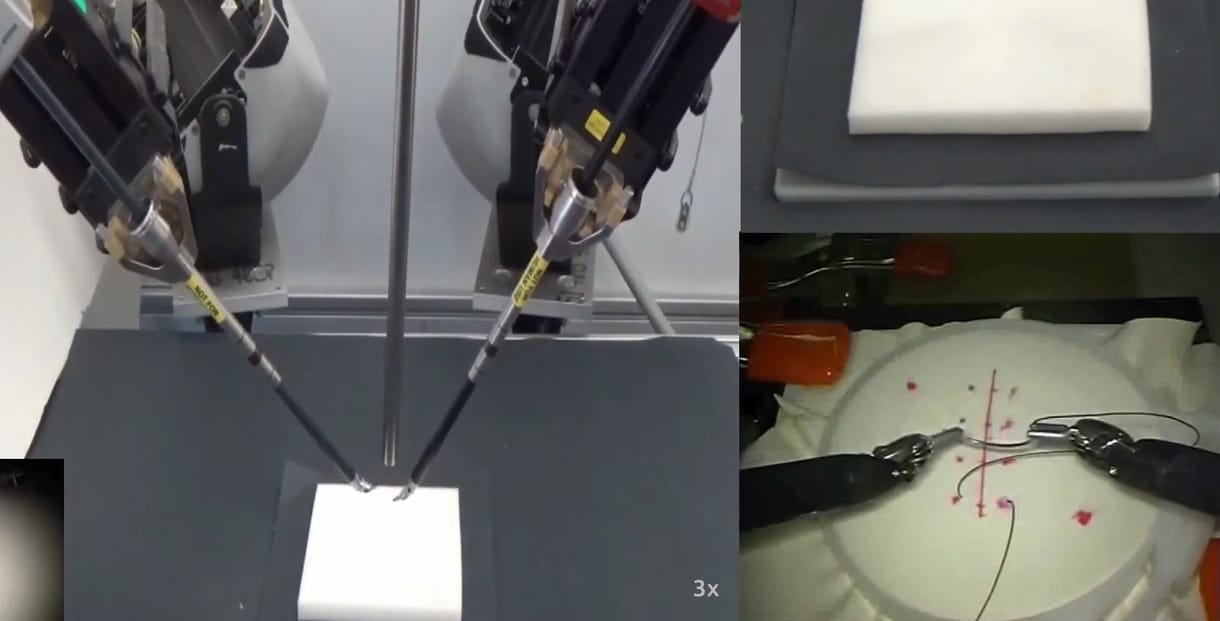 Megnézett 78 műtétet videón, úgy tanult meg sebet összevarrni egy kórházi robot
