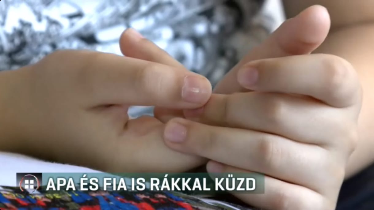 Egy magyar apánál és 10 éves fiánál is rákot diagnosztizáltak az orvosok