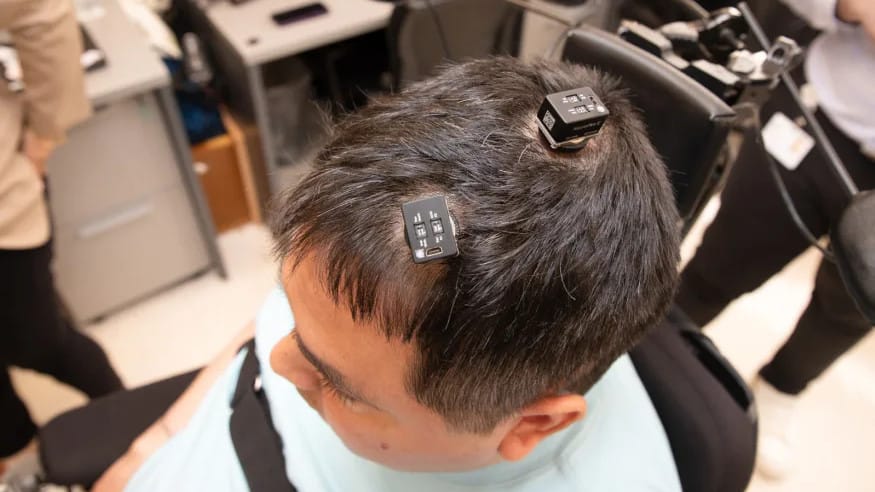 15 órás műtéttel, agyimplantátummal és MI-vel érték el orvosok, hogy egy lebénult férfi újra mozgathassa a karját, és érezhesse az érintéseket