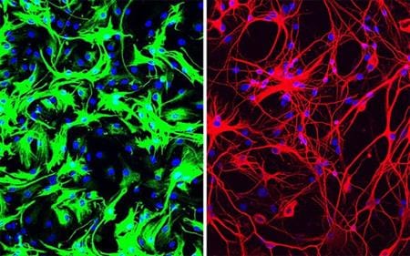Egerekben már működik a sejtszerepcsere, amely enyhítheti a Parkinson-kór tüneteit