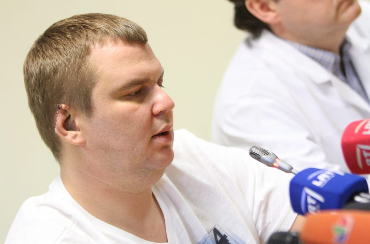 Fotó: megmutatta sérüléseit a levágott fülű ukrán ellenzéki