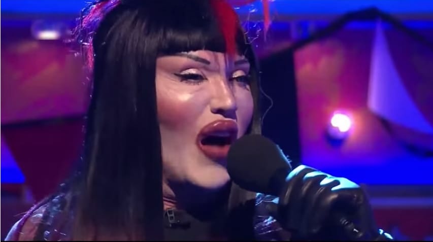 Meghalt Pete Burns, az agyonműtött arcú énekes