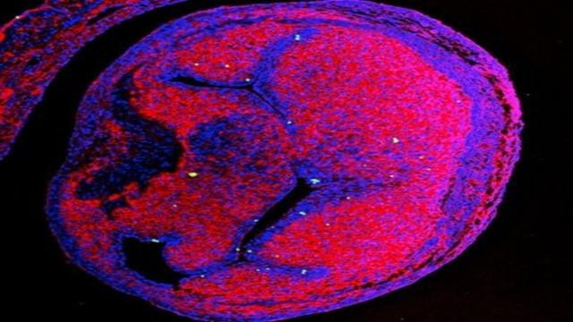 Ijesztő dologra jöttek rá biológusok: olyan szívszövetekbe is eljuthatnak a nanoműanyagok, ahová erek nem is vezetnek
