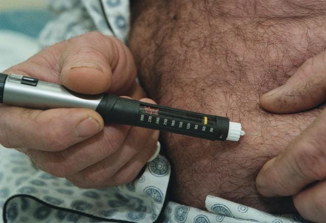 Műtét segíthet az elhízott cukorbetegeknek
