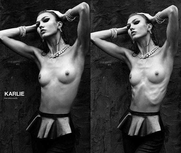 Photoshop-botrány: hússal töltötték fel a modell kiálló bordáit