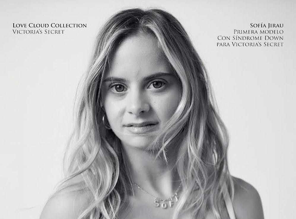 Ő a Victoria’s Secret első Down-szindrómával élő modellje