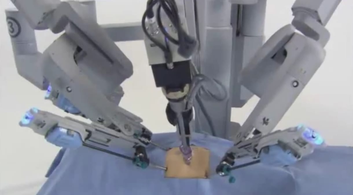 Ébren volt a páciens, amikor a robot eltávolította a daganatot a testéből
