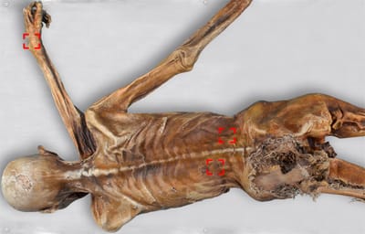 Iceman, azaz Ötzi ősünk tetoválásai