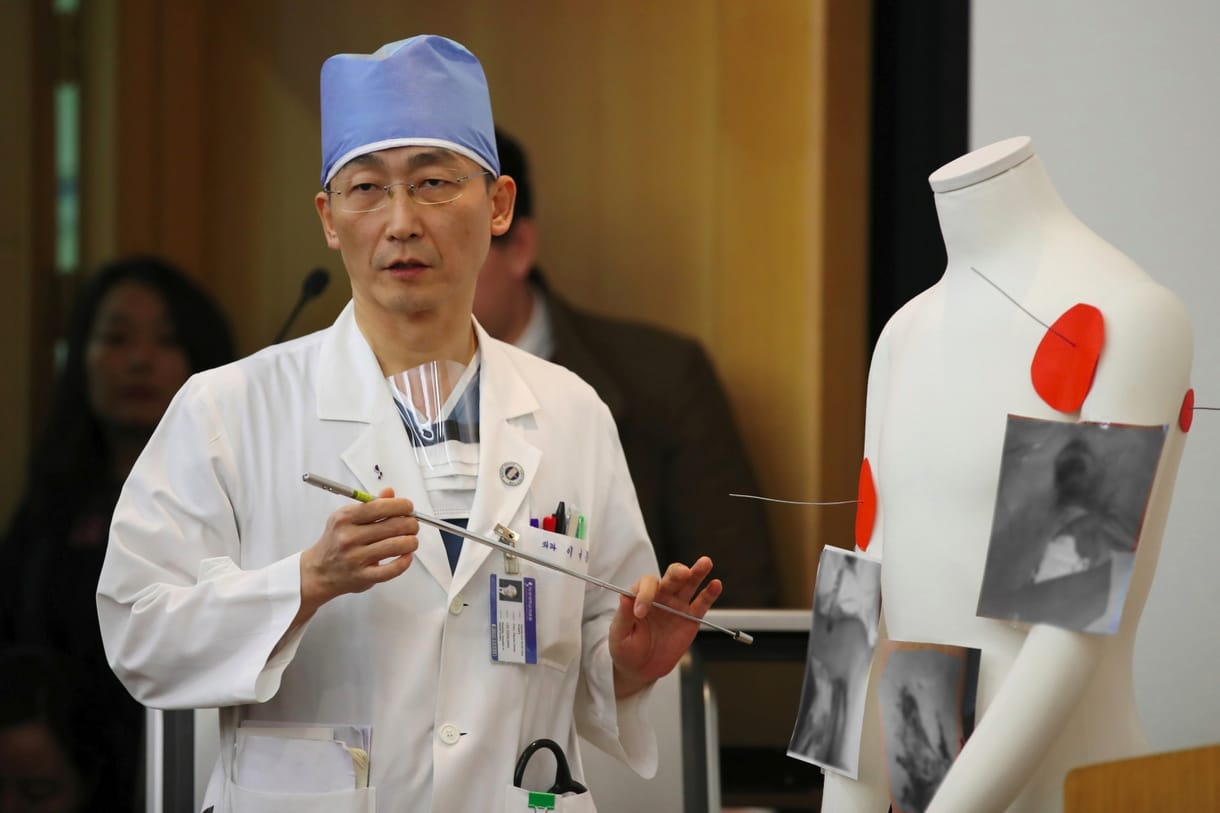 27 cm hosszú férget távolítottak el egy észak-koreai katonából