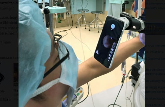 Ilyen is van: iPhone mutatja, amit az endoszkóp lát