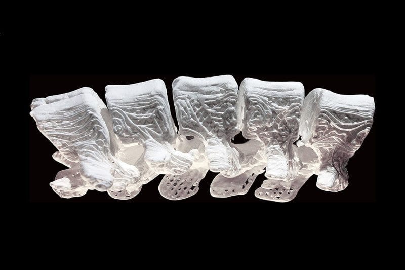 Hatalmas lökés az orvostudományak: olyan implantátum készült, ami csonttá válik a betegben