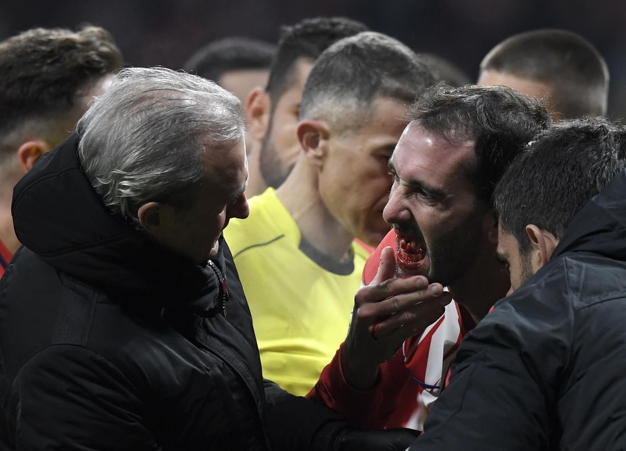 A pályán hagyta a fogait az Atlético védője