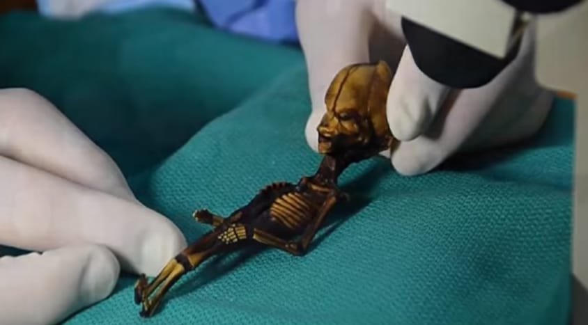 Megfejtették a chilei törpe múmia titkát