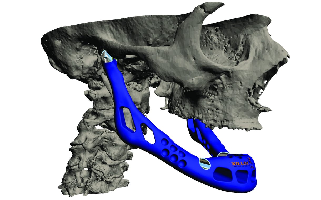 Csokitorta, ékszer és emberi szív a 3D-nyomtatóból 