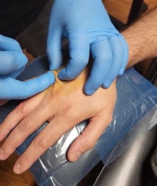 A bőre alá ültette a „kocsikulcsát” egy Tesla-tulajdonos