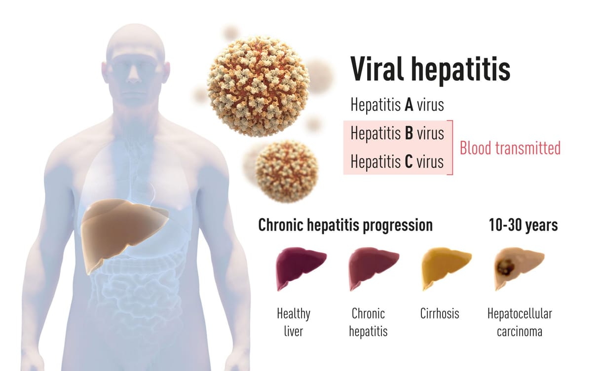 A hepatitis C-vírus felfedezéséért kapták az orvosi Nobel-díjat