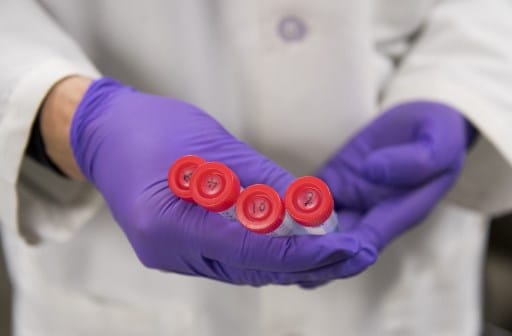 Még mindig nem biztos, hogy megkaphatják a fiúk a HPV elleni oltást ősszel