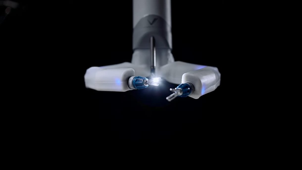 Kipróbálták a robotsebészt egy szaúdi kórházban, óriási sikeraránnyal dolgoznak az orvosok