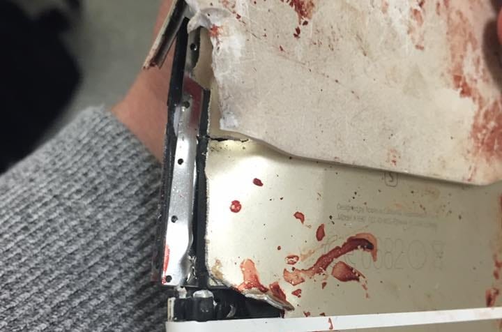 Azért élte túl a manchesteri robbantást egy nő, mert éppen a kezében volt a telefonja – fotók